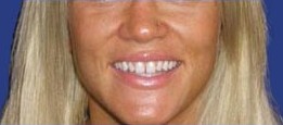 Lumineers before