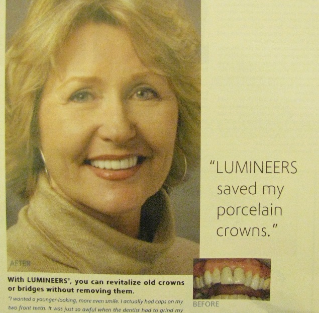 An ad encouraging dentists to place Lumineers over crowns.
