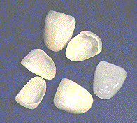 porcelain venneers